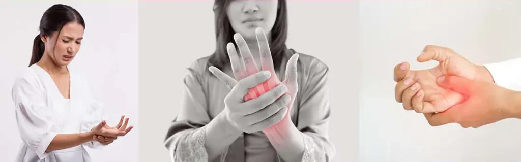 Women experiencing hand pain and inflammation, representing the reality that arthritis affects millions under age 65